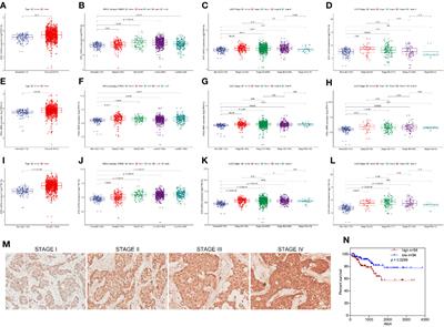 siMTA1-Loaded Exosomes Enhanced Chemotherapeutic Effect of Gemcitabine in Luminal-b Type Breast Cancer by Inhibition of EMT/HIF-α and Autophagy Pathways